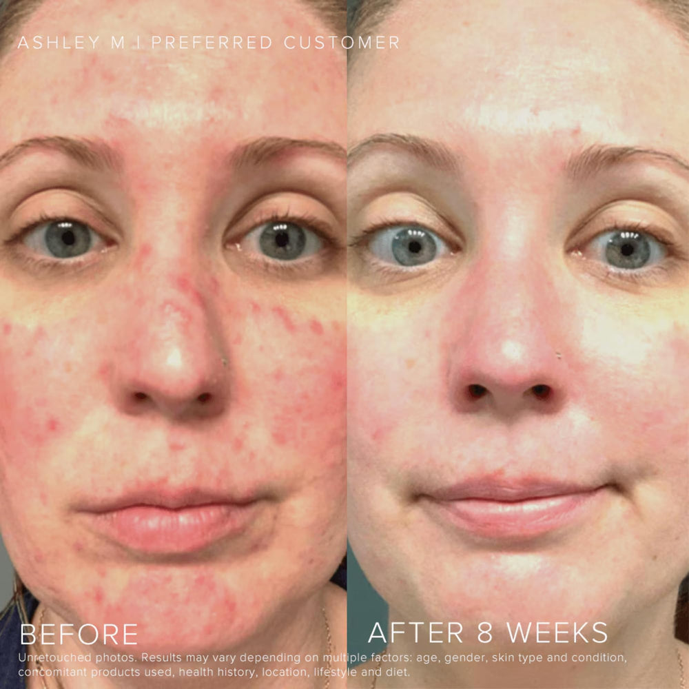 Rodan + Fields Soothe Face Wash texture demonstrates gentle cleansing for comfort.