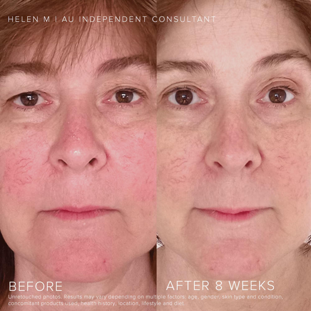 Rodan + Fields Soothe Moisturizer jar provides deep hydration for sensitive skin.