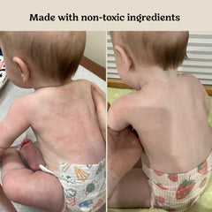 Roe Wellness serum in hand applying to baby's cheek for soothing care