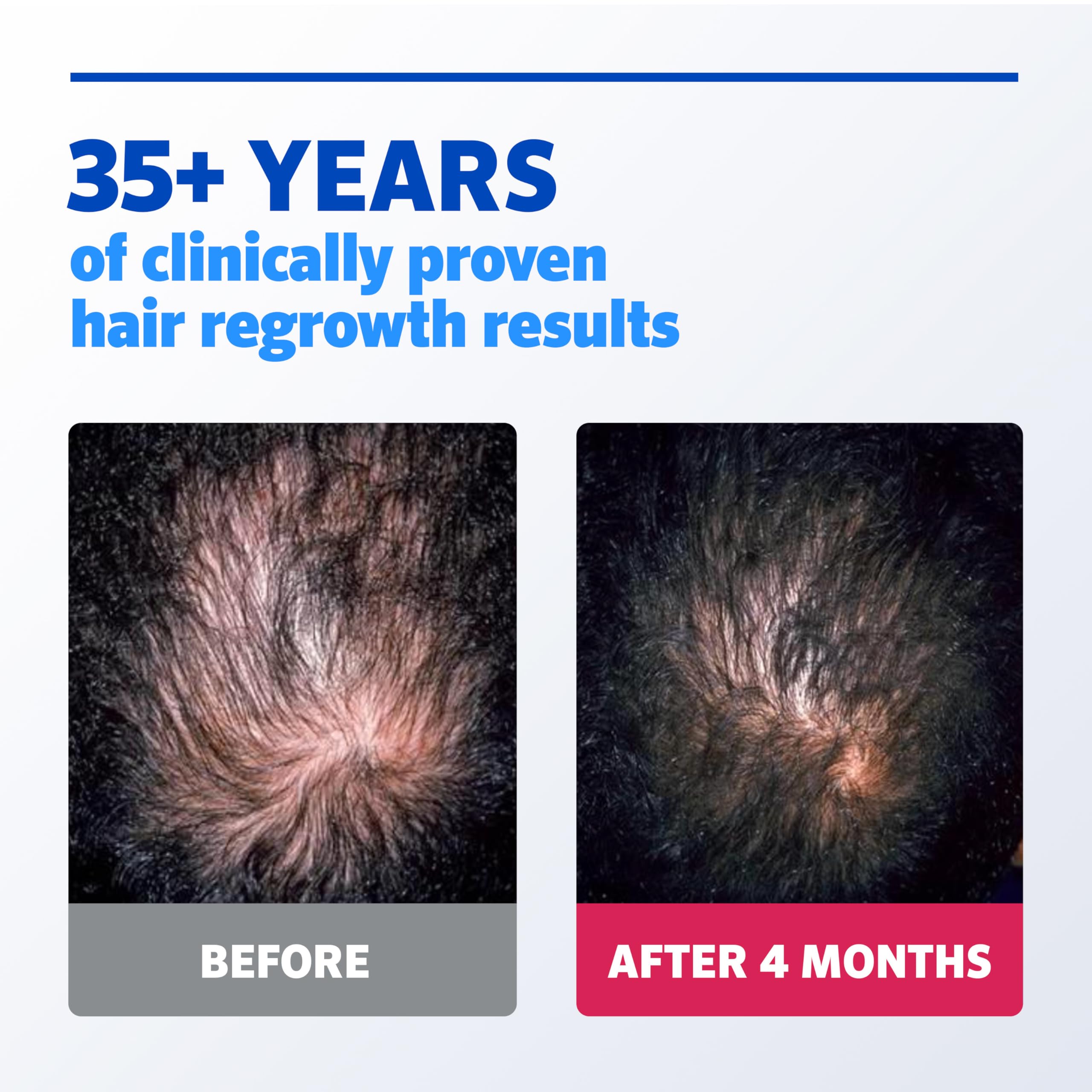 Rogaine daily routine steps with three-month supply