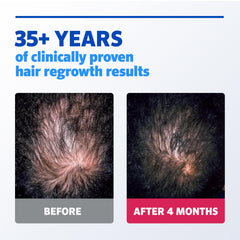Rogaine daily routine steps with three-month supply
