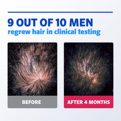 Rogaine foam massage on scalp supports follicle activity during routine.