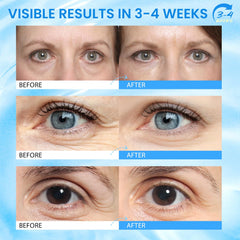 RONKIE Caffeine Eye Stick helps reduce puffiness and under-eye swelling.