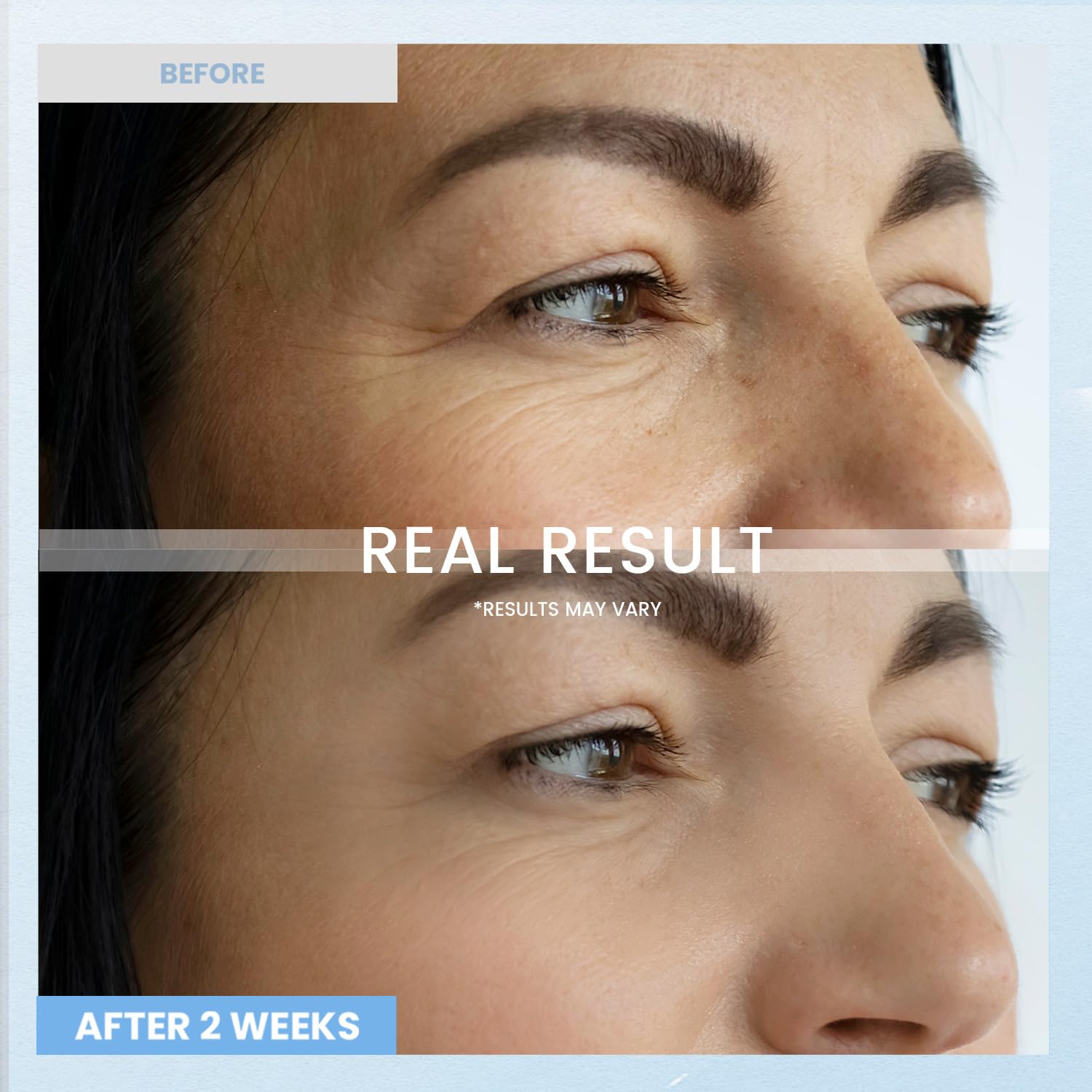 RONKIE Retinol Eye Cream on skin delivering deep hydration for a refreshed look.