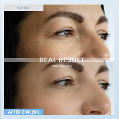 RONKIE Retinol Eye Cream on skin delivering deep hydration for a refreshed look.