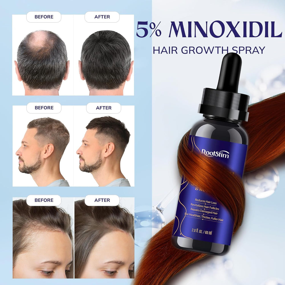RootStim application on clean dry hair demonstrating precise use.