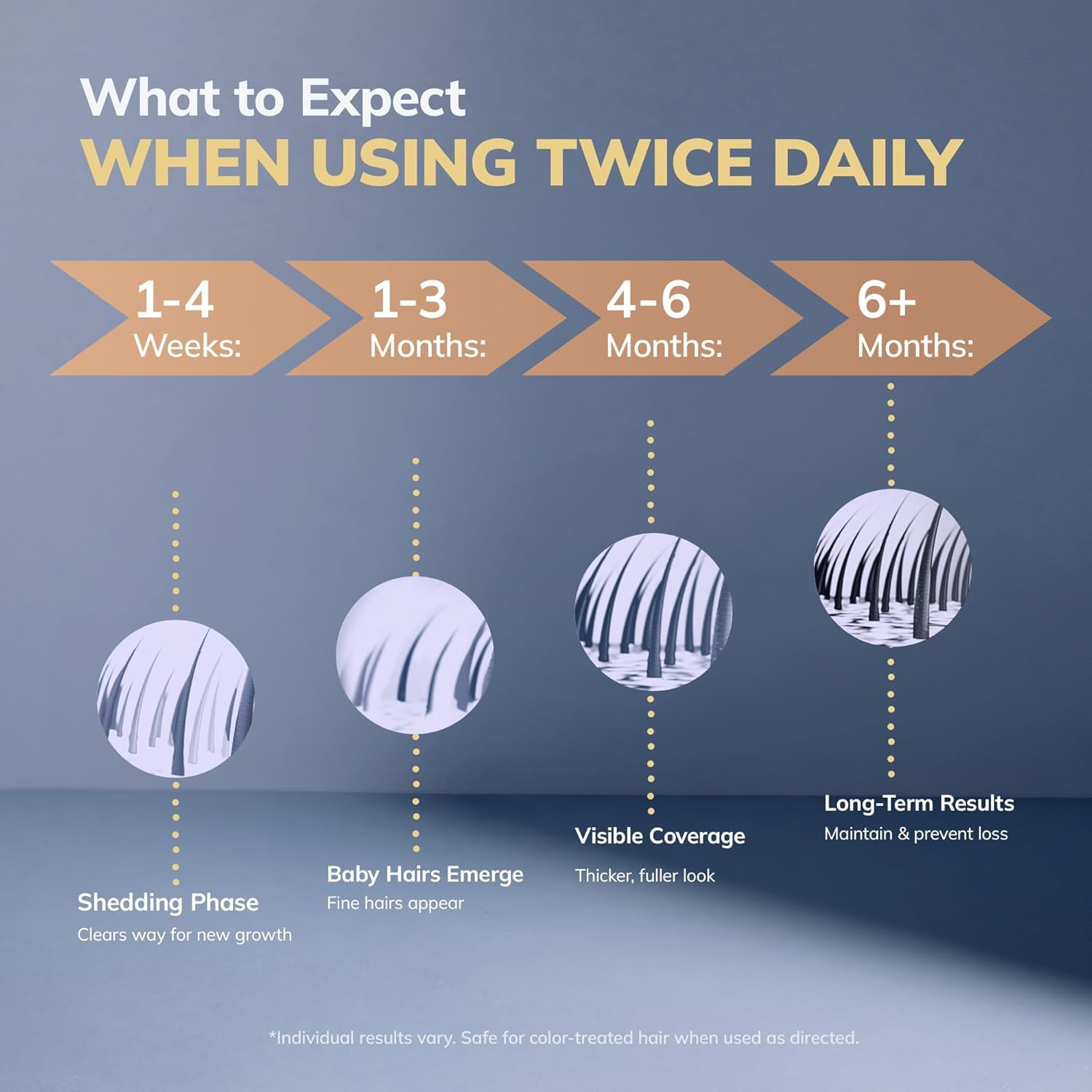 RootStim hair growth kit packaging shown with clear instructions.