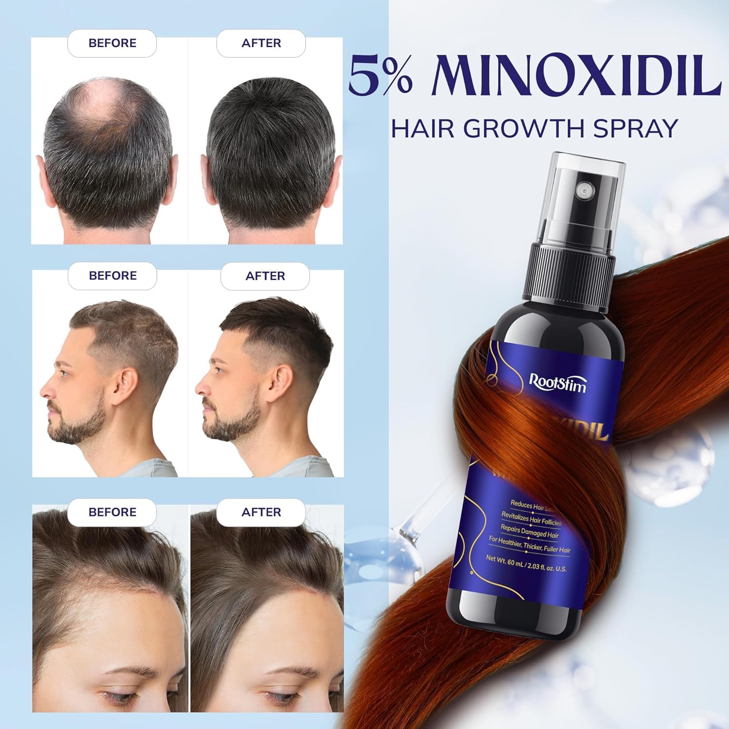 RootStim minoxidil rosemary bottle close-up highlighting herbal infusion