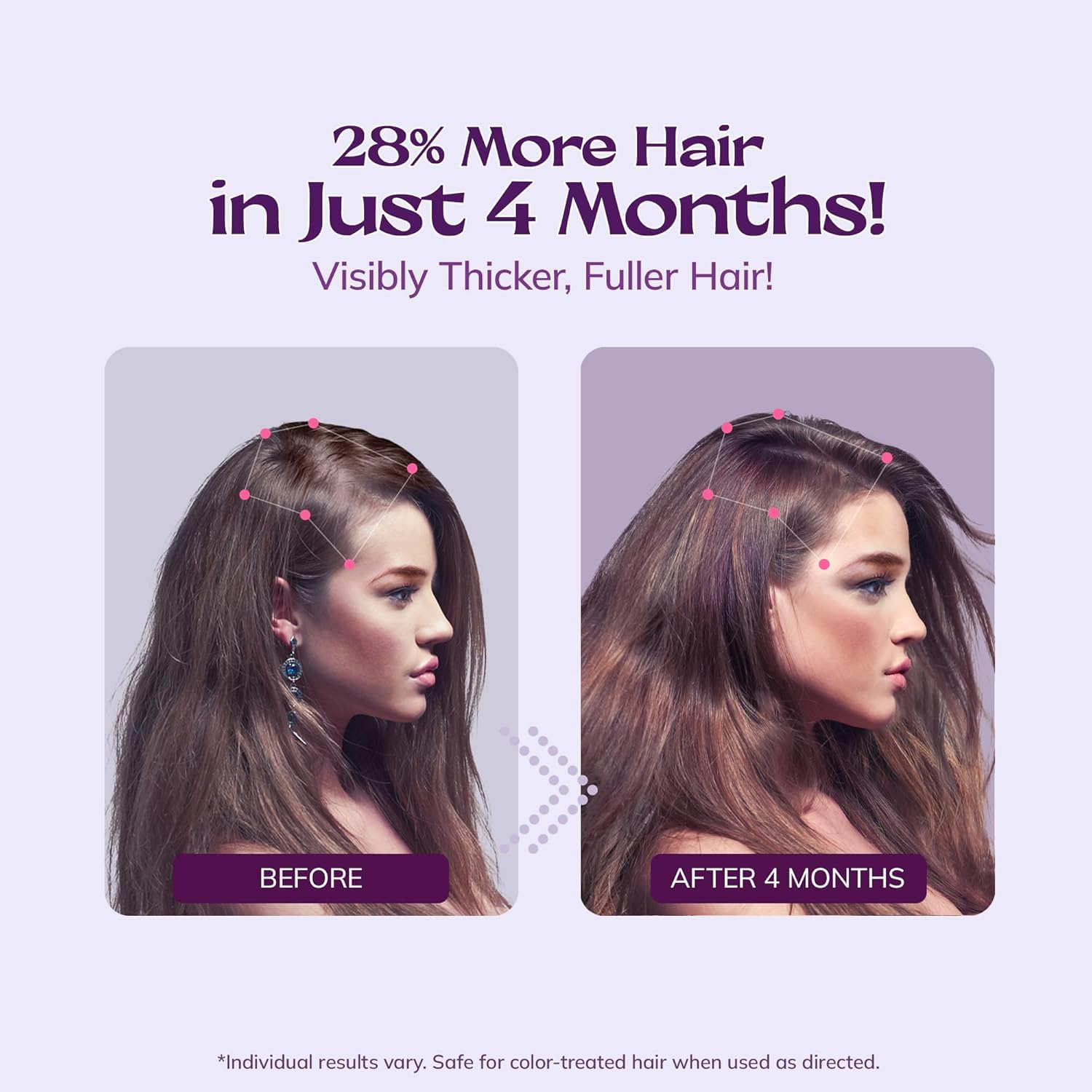 RootStim rosemary and biotin scalp nourishment improves root health.