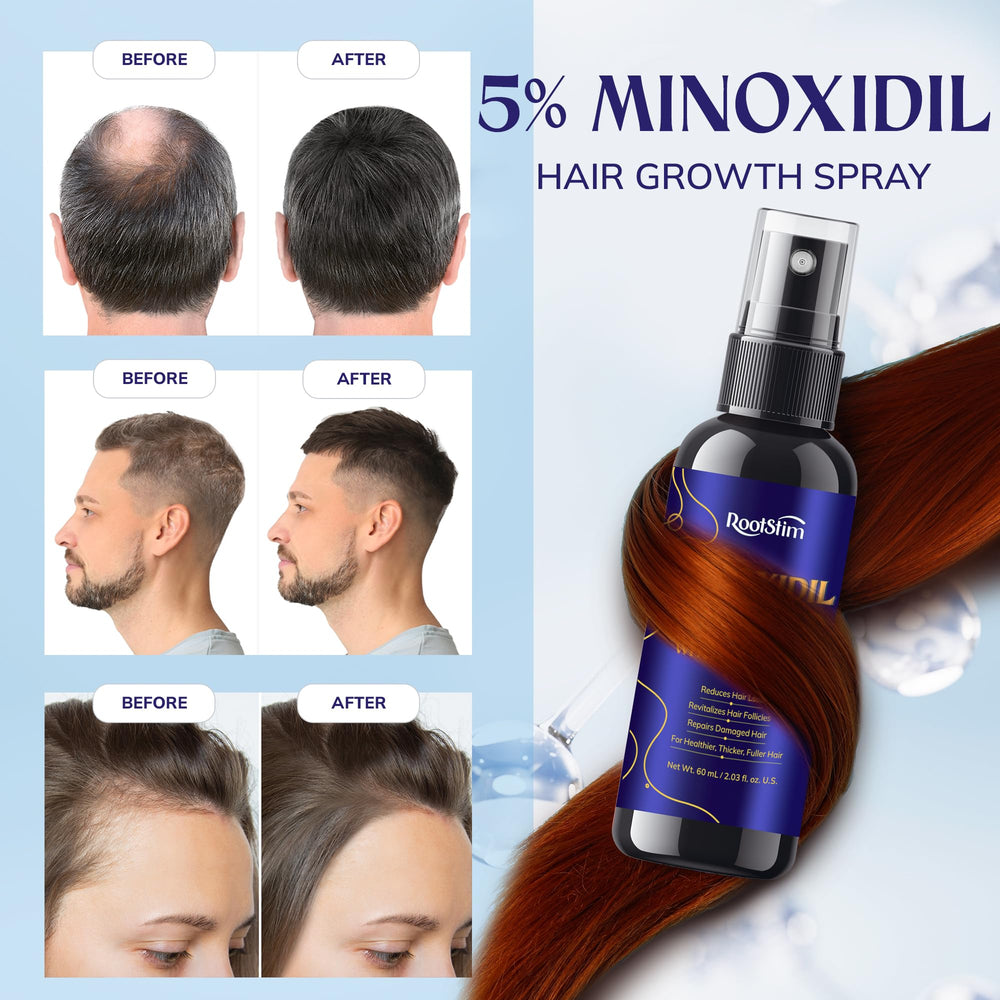 RootStim scalp application on clean, dry hair for targeted care.