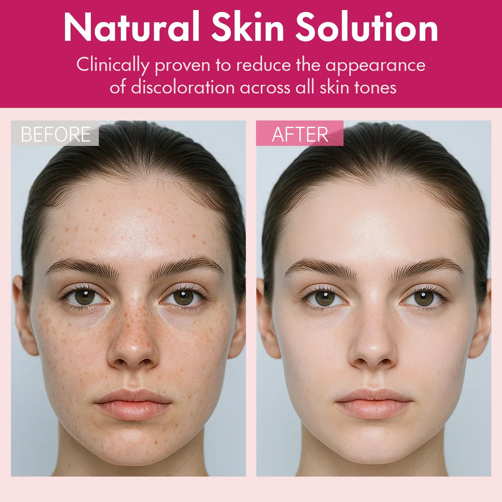 Roseblem fragrance free formula supports sensitive skin with gentle care.
