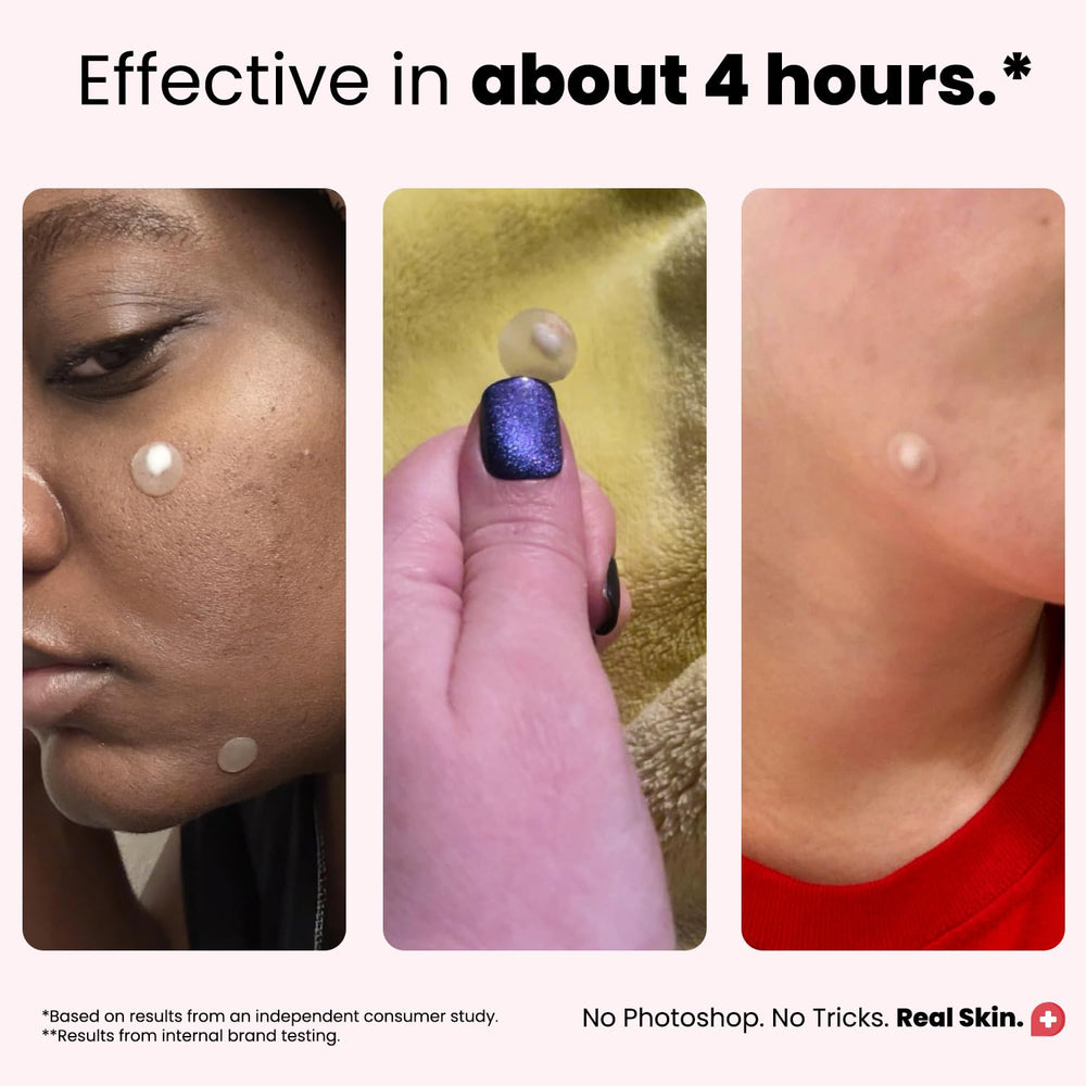 ROSELYNBOUTIQUE patch on blemish demonstrates quick 3-step night routine.