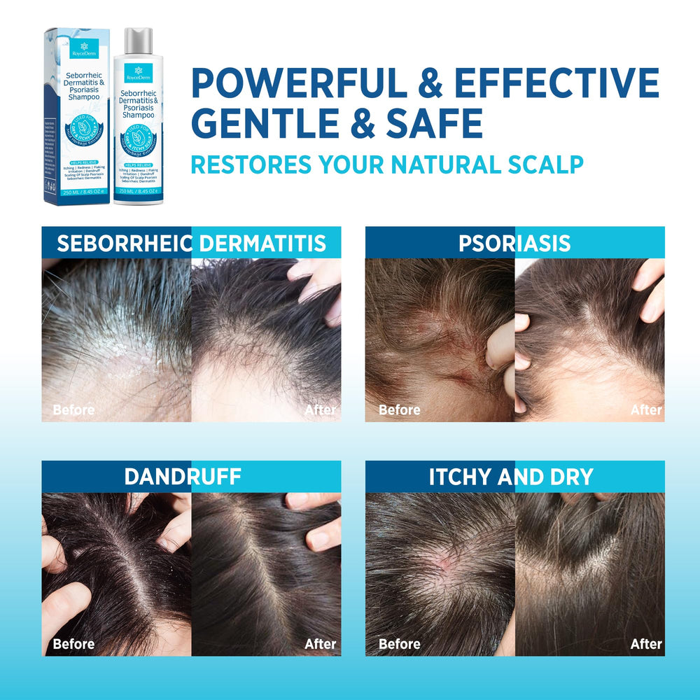 Roycederm face cream label close-up highlighting fragrance-free formula