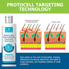 Roycederm Psoriasis Shampoo foam close-up indicates gentle application