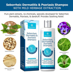 Roycederm Psoriasis Shampoo scalp view shows soothing care during treatment