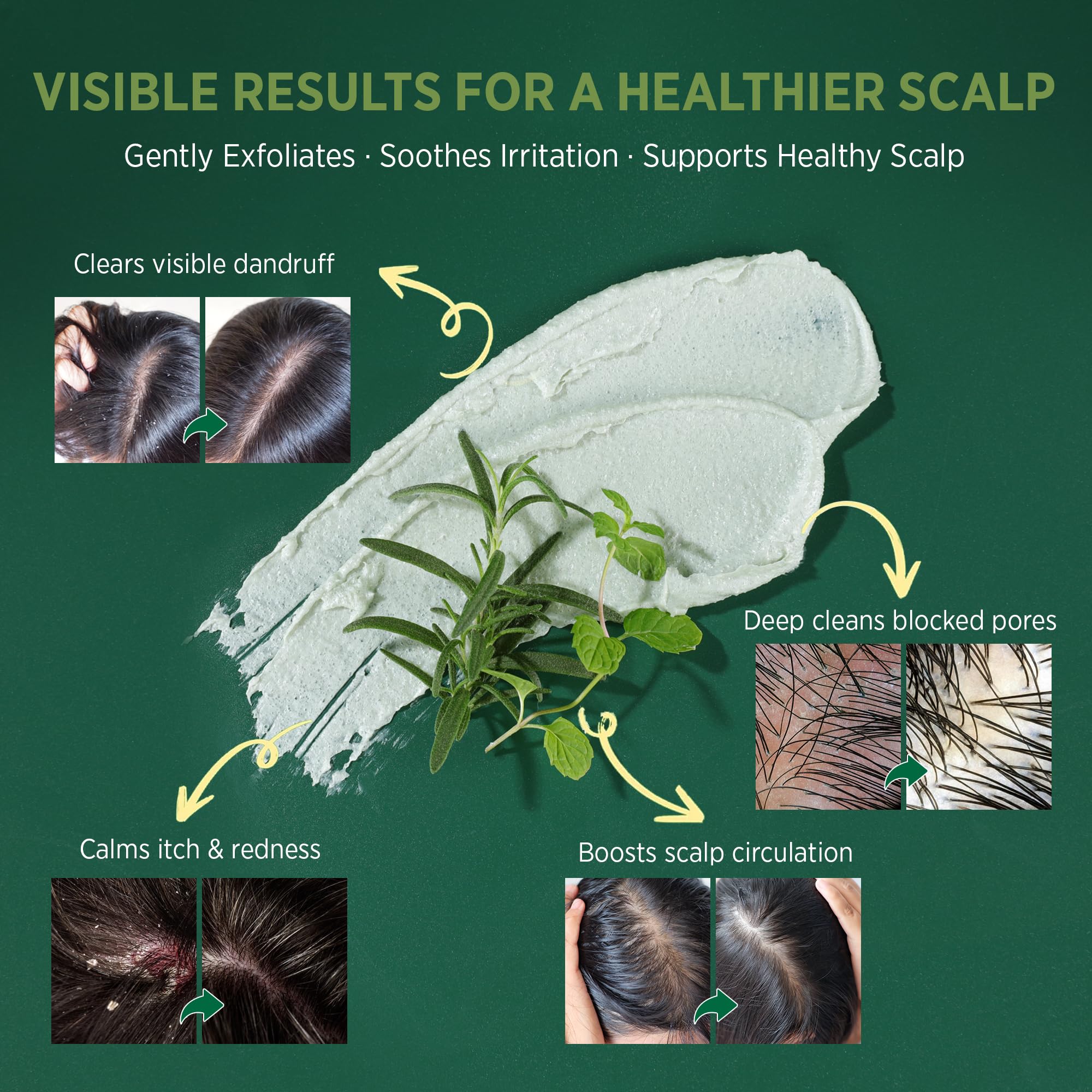 RoyceDerm rosemary oil drop close-up highlighting calming scalp care