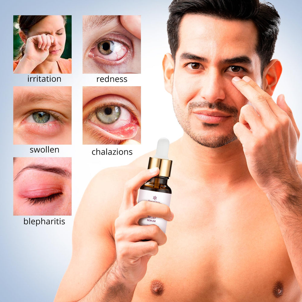 Applying Roycederm serum with clean finger on the outer eyelid for comfort.