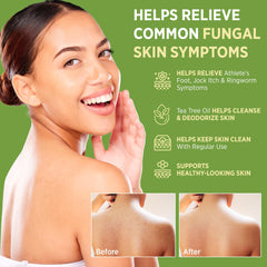 RoyceDerm tea tree scented bar providing a refreshing wash experience.