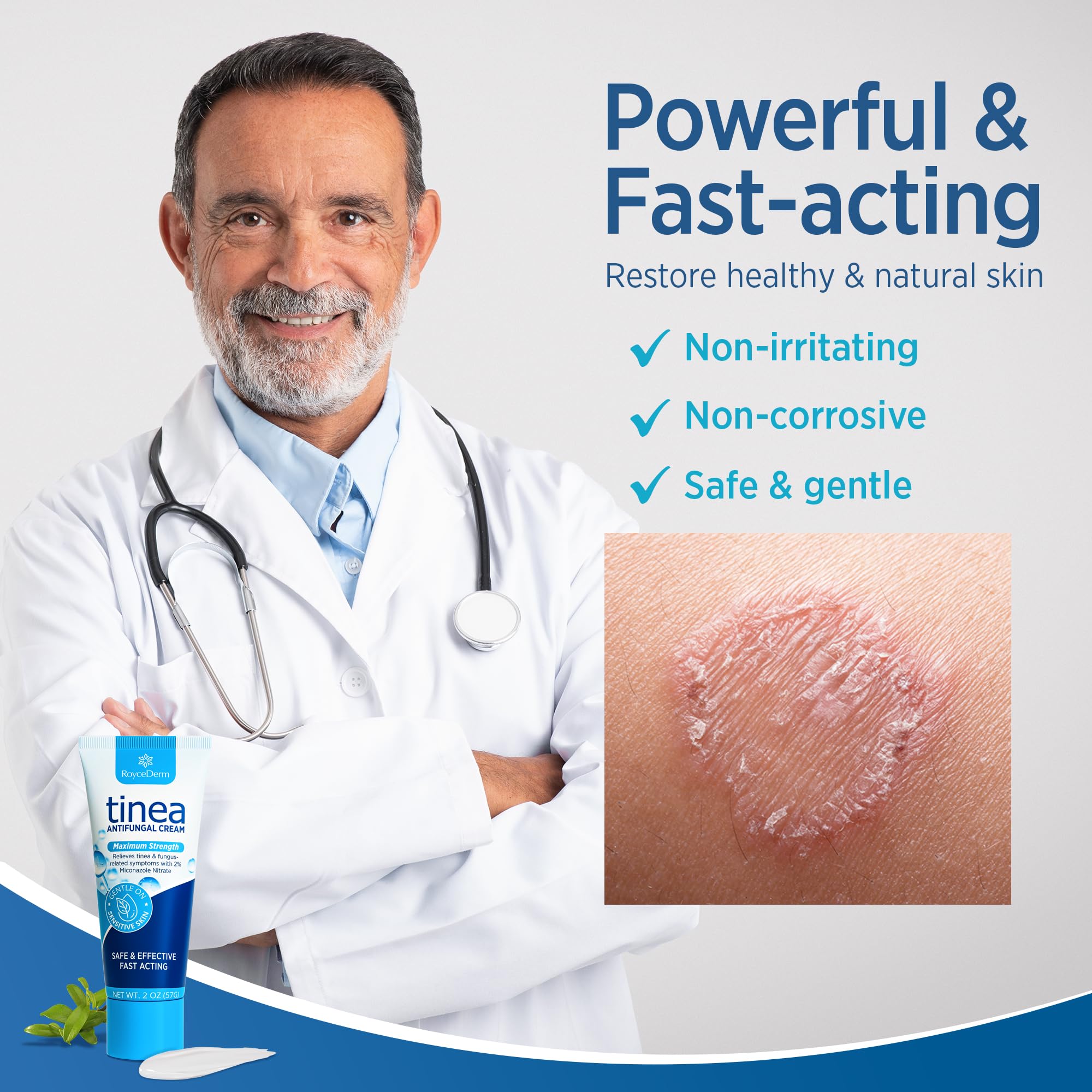 Roycederm tinea treatment closeup of cream texture reveals gentle, paraben-free formula