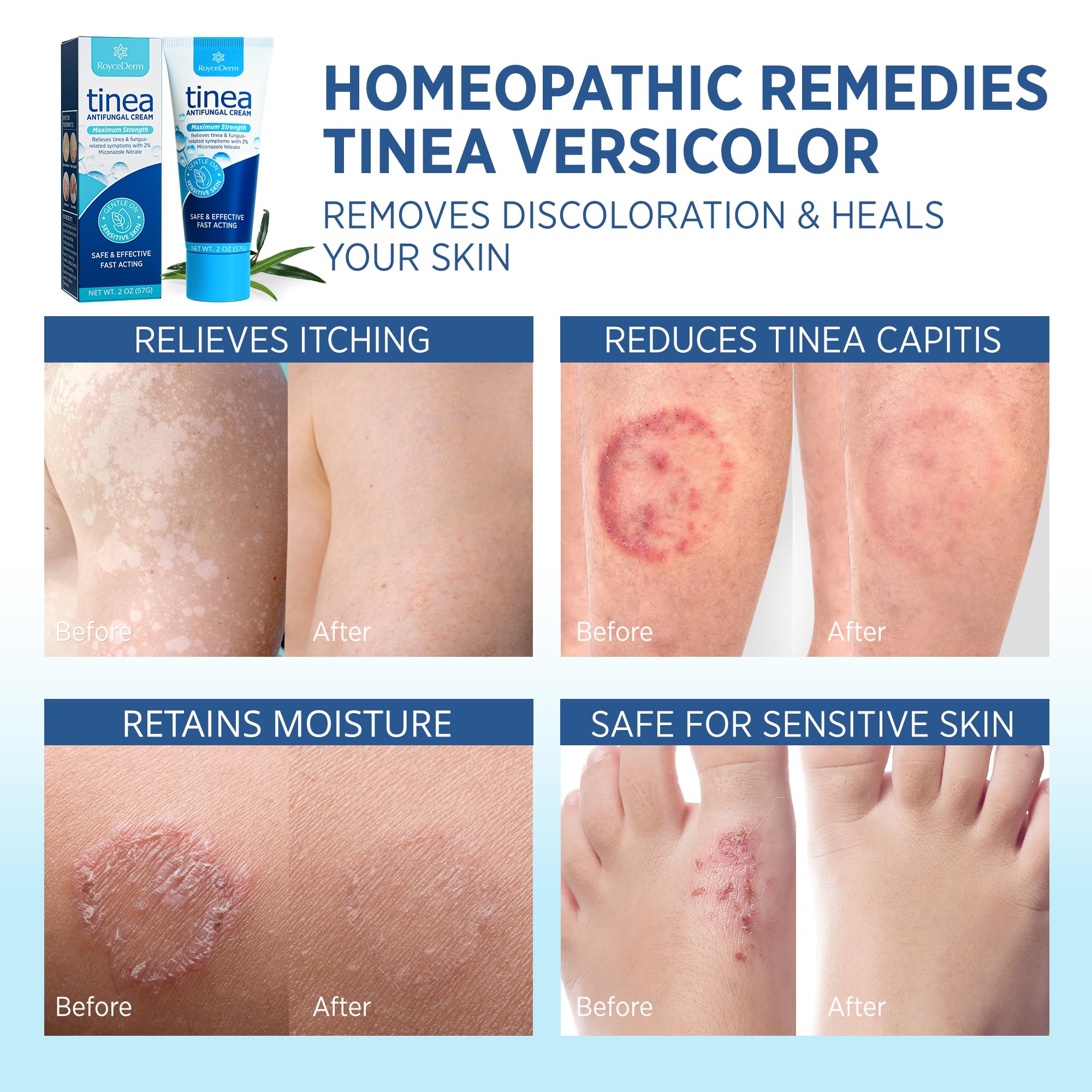 Roycederm tinea treatment label highlights multi-functional antifungal properties for humans