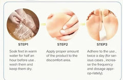 ROZINO Alcarol turmeric cream being applied to hands for soothing moisture