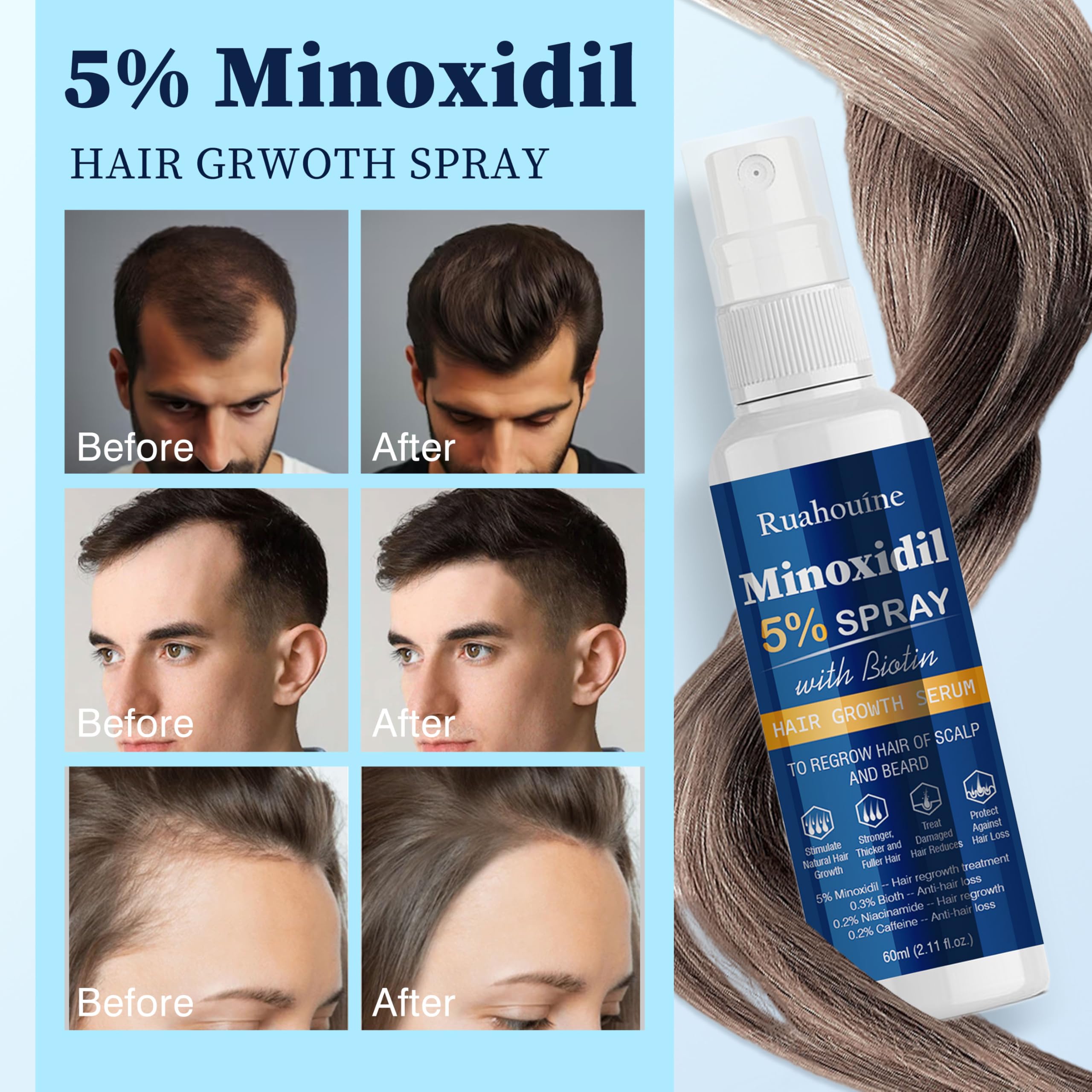 Ruahouine Minoxidil spray for beard area and facial hair coverage