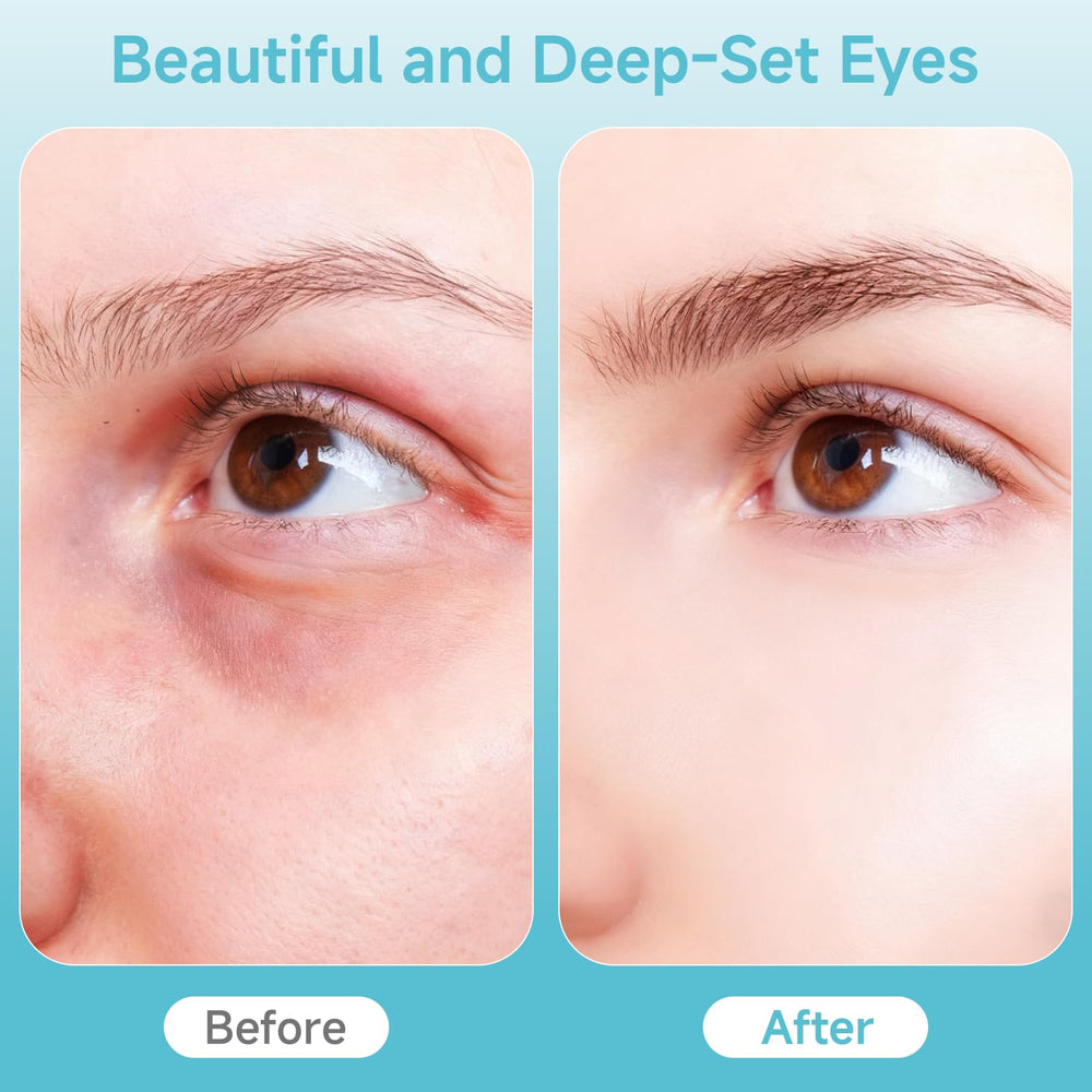 Ructmou Eye Care Wand glow-focused massage for refreshed under-eye skin
