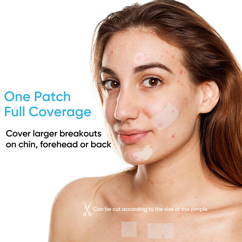 Rulvcian transparent patch on skin shows discreet, comfortable acne care.