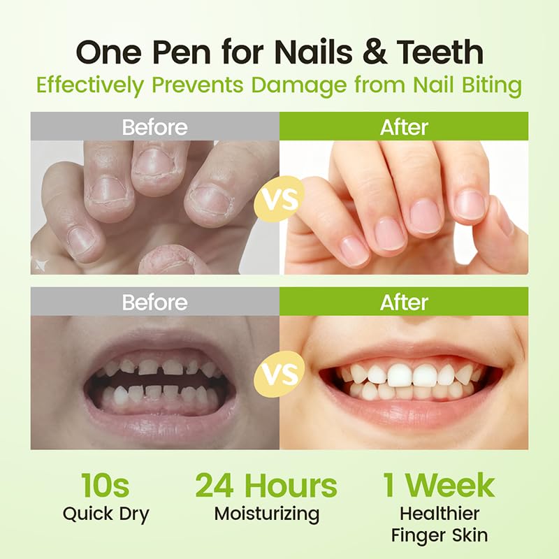 RUNBEN 5-in-1 plant oil blend supports nails and cuticles