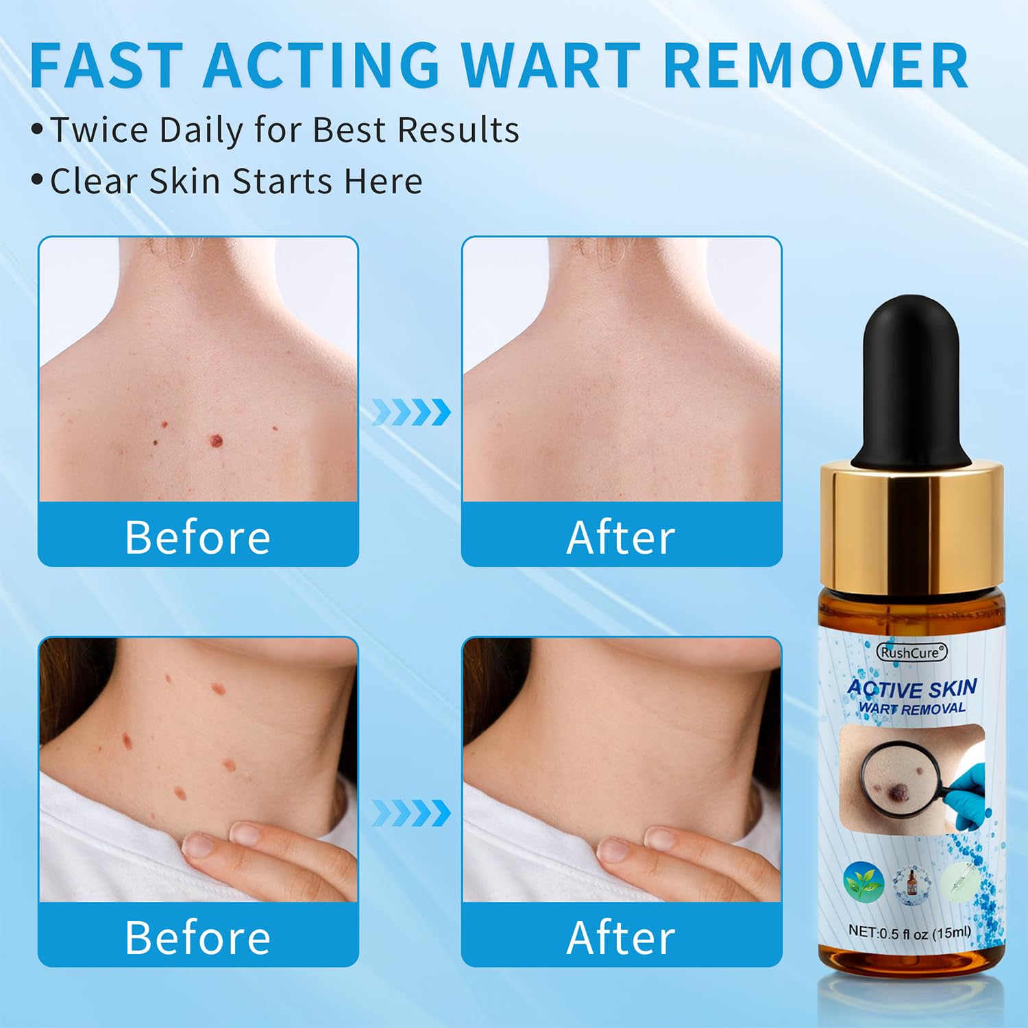 RushCure travel-size wart remover fits in pockets for on-the-go care