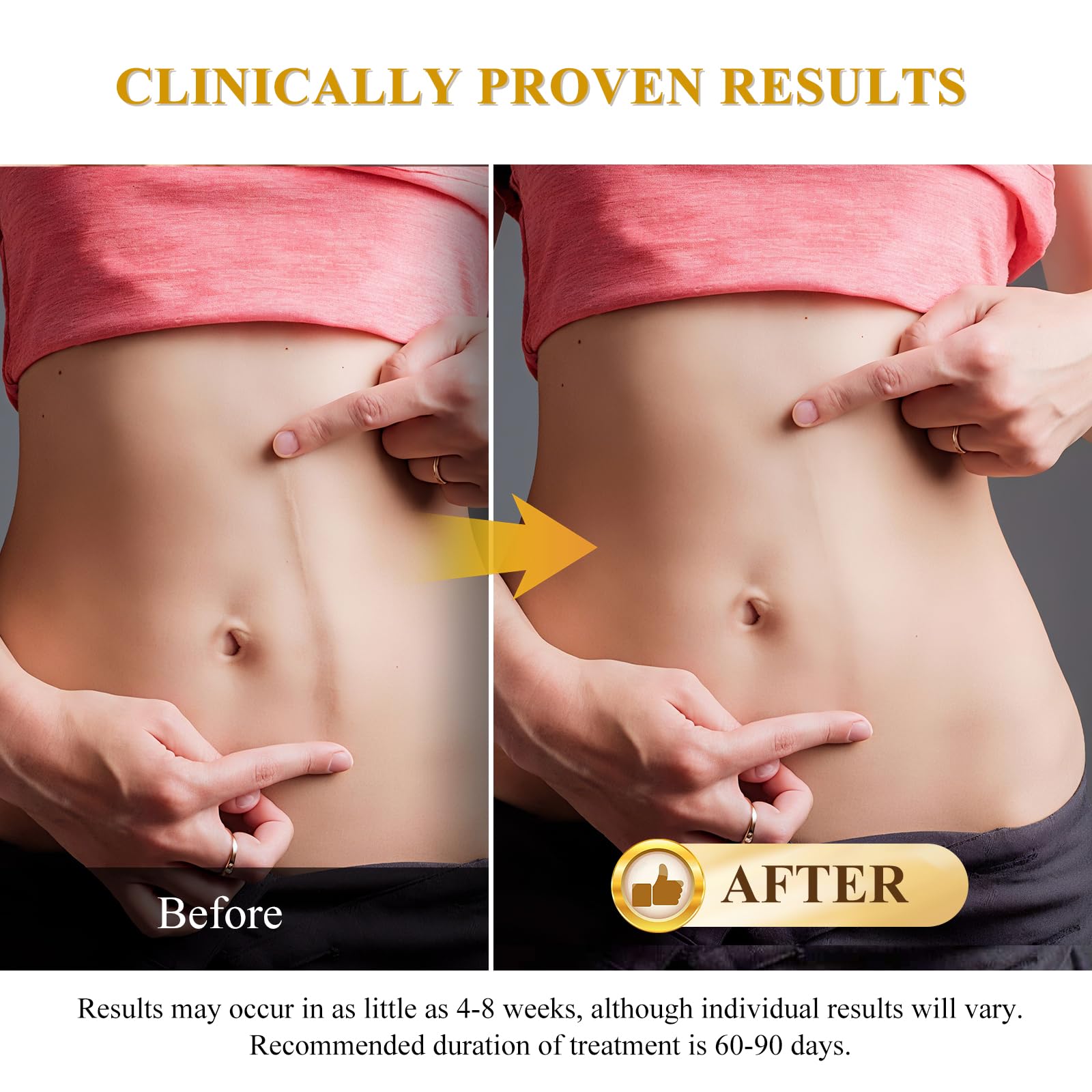 Rvlaim scar care before and after visuals illustrating potential changes.