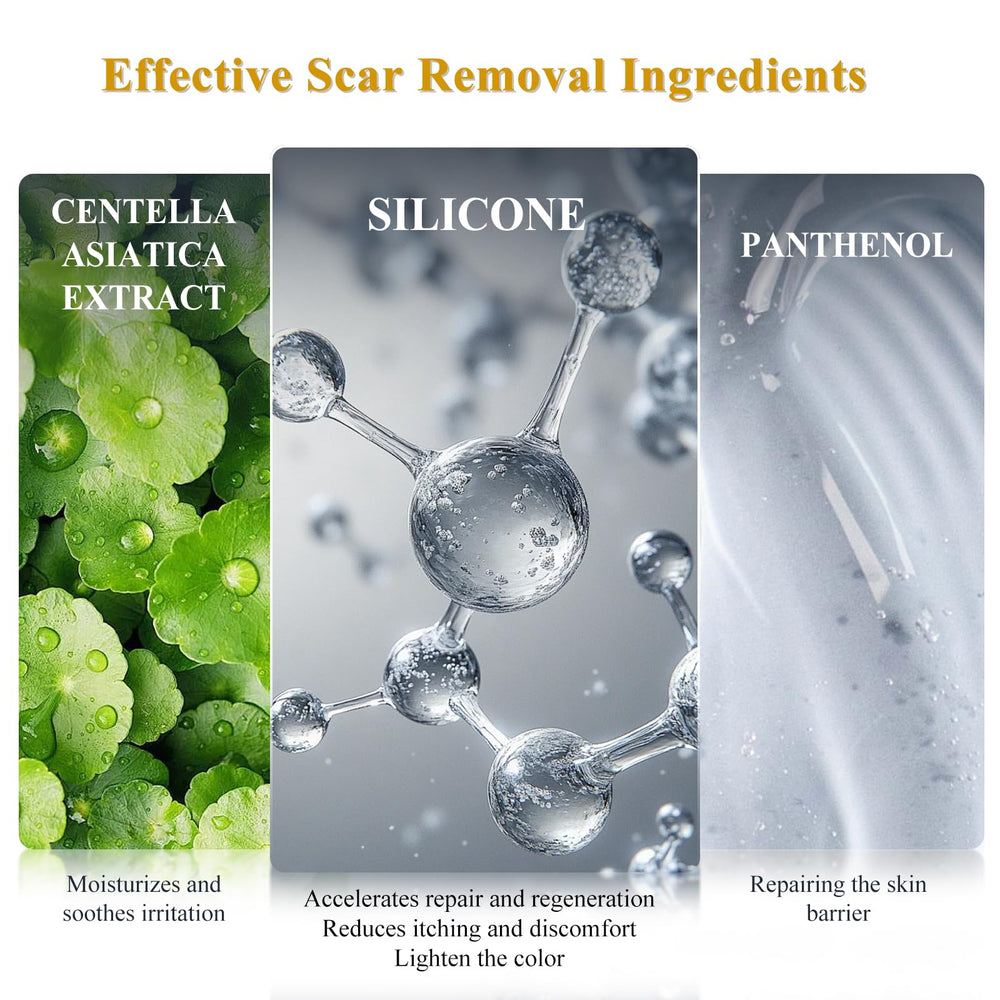 Rvlaim scar cream ready for twice-daily use.