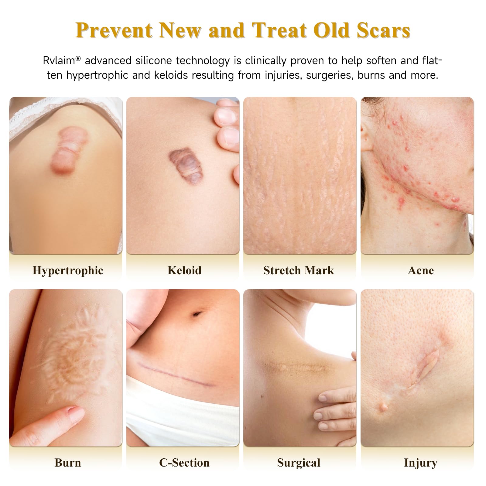Rvlaim silicone scar gel texture showing fast absorption.