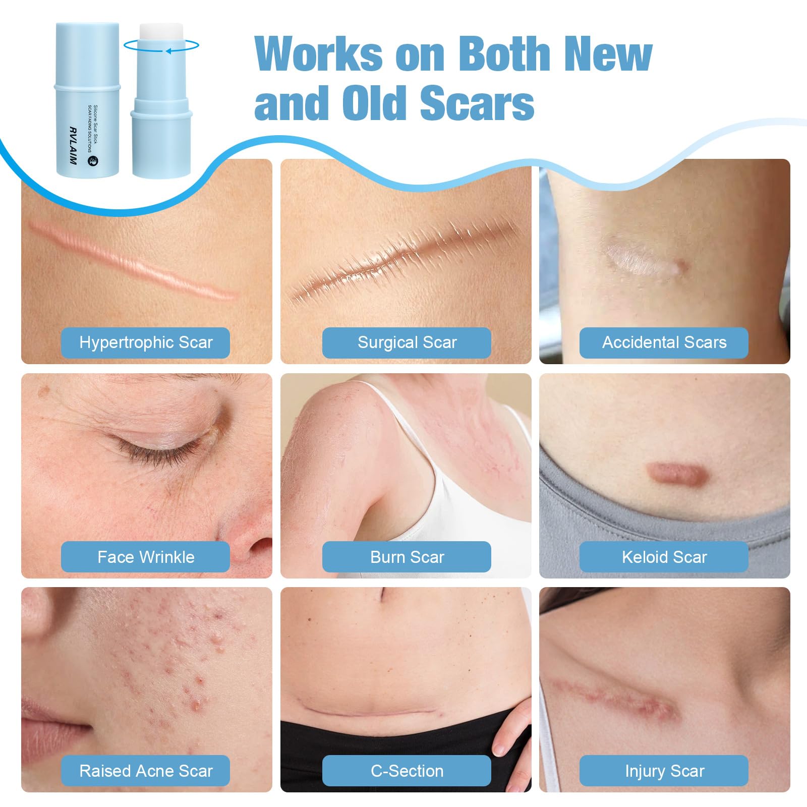 Rvlaim fragrance-free formula supports gentle scar care without irritation.