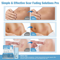 Rvlaim travel-friendly design fits in bags for on-the-go scar care.