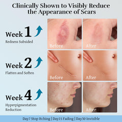 RWT Silicone Scar Cream supports smoother skin on postoperative scars.