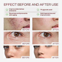 Close-up of label highlighting seven percent glycolic acid content for SADOWAY Toner.