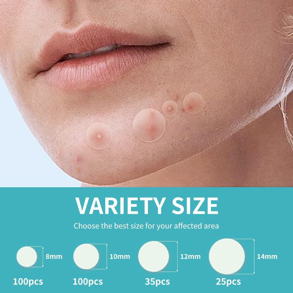 Safirst acne patches visible on face provide discreet blemish coverage