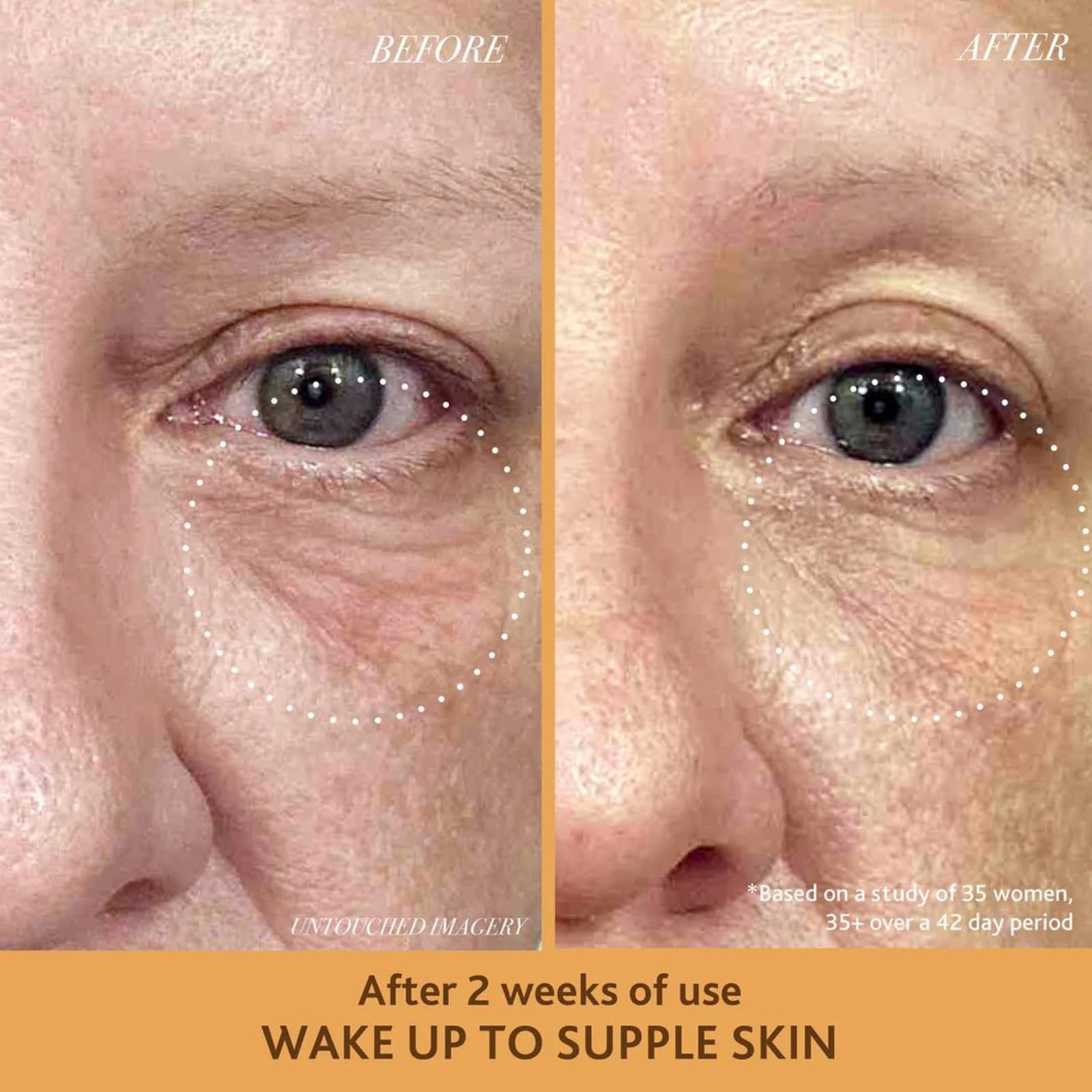 Under-eye area after applying Sahajan Golden Glow Eye Balm for a brighter look