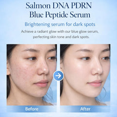 Salmon DNA PPRN Serum hydration with six Hyaluronic Acids in action.