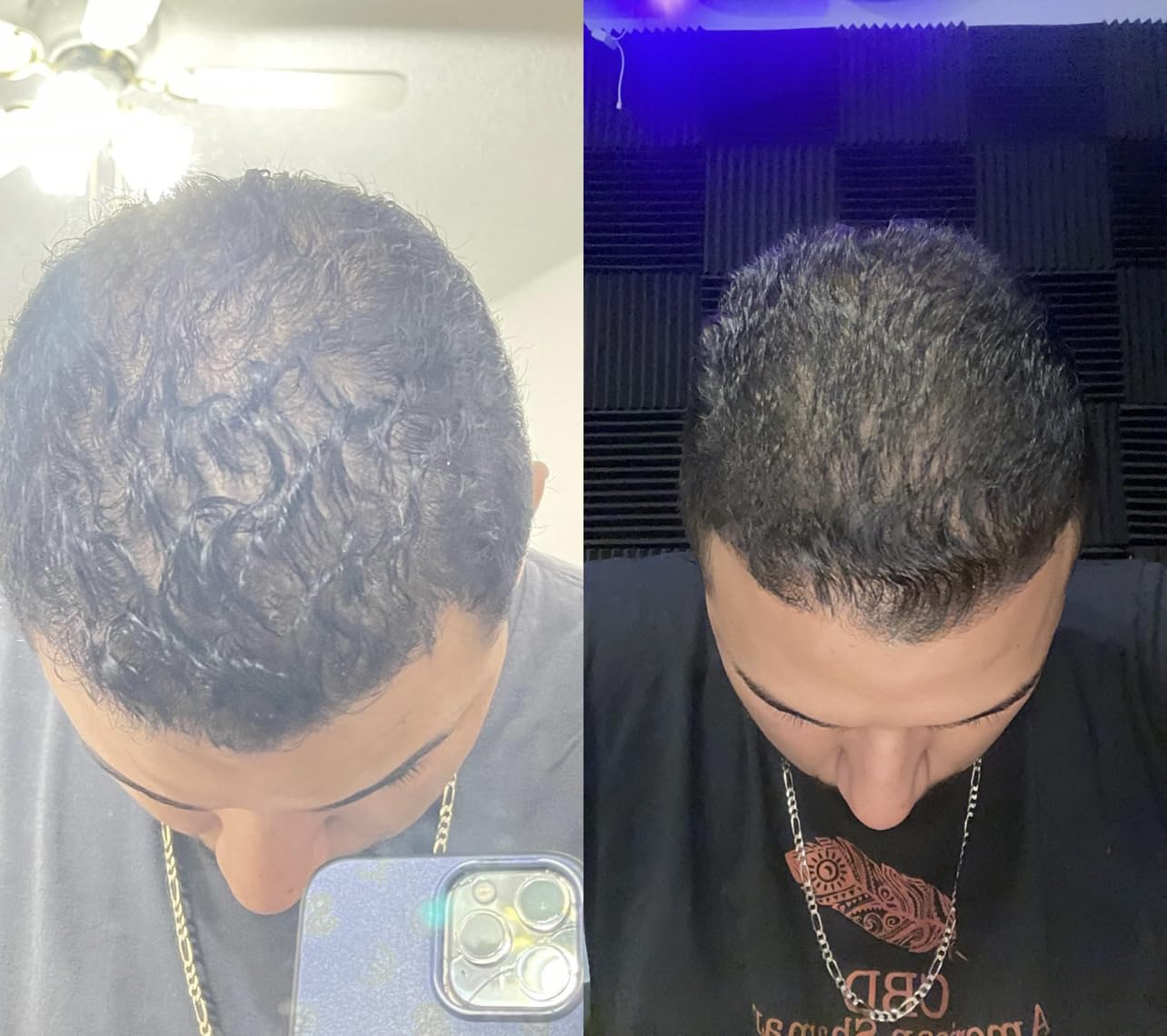 Samson & Son's Hair Regrowth Serum bottle on wood surface feels premium.