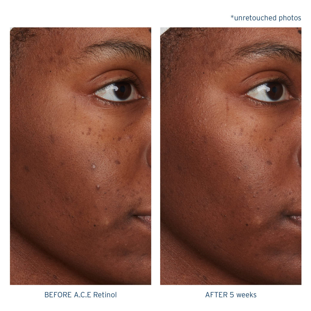 Santo Remedio Nighttime routine image shows an easy nightly step