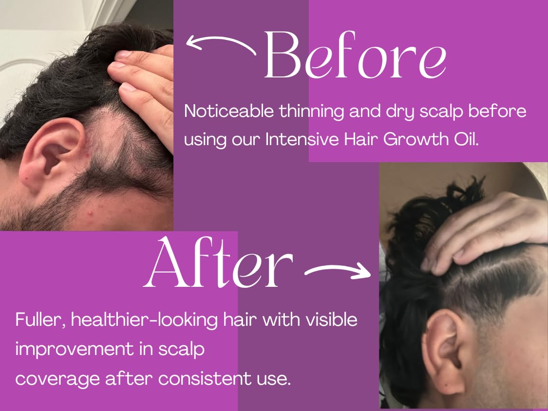 SARQI Hair Growth Oil on shelf shows ready-to-use nourishment