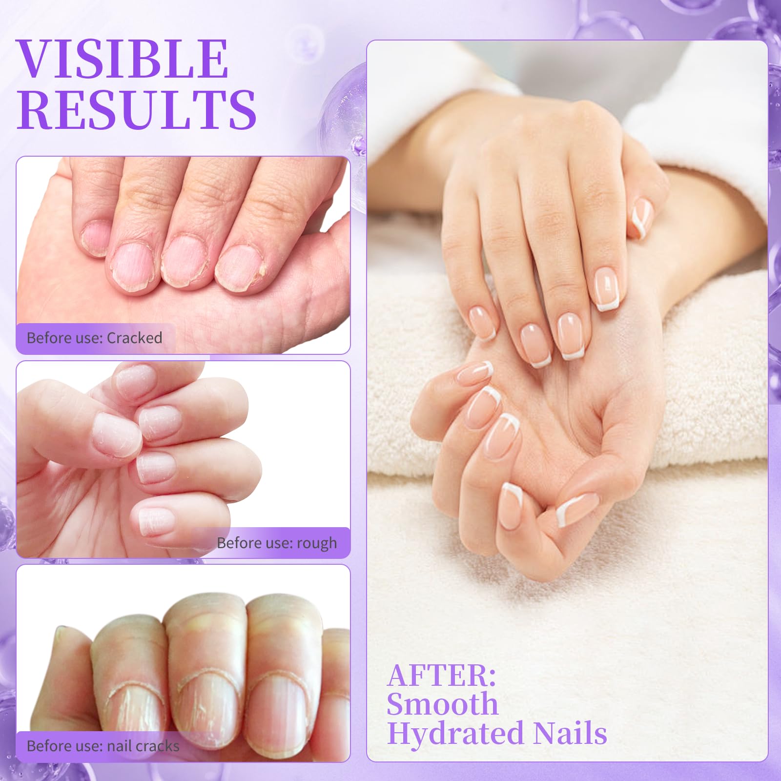 SASSYTIP all-in-one nail care for quick at-home maintenance.