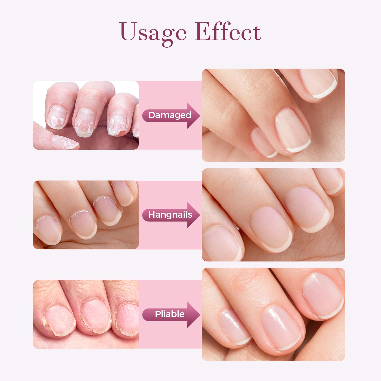 SASSYTIP rose-scented nail care for a relaxing manicure moment