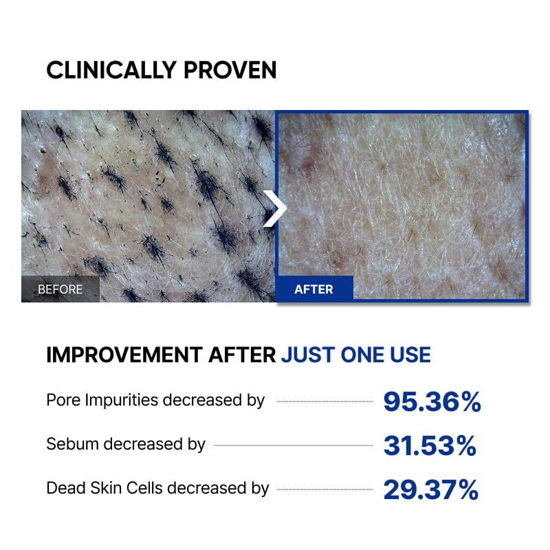 SAYNID glass-skin finish close-up with radiant, smooth complexion.