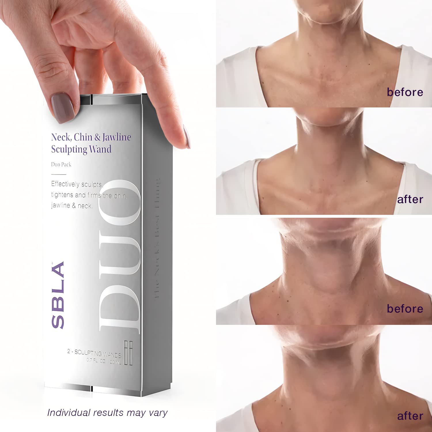 SBLA clinical neck-tightening result visual suggesting smoother contours.