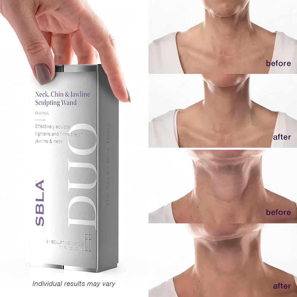 SBLA clinical neck-tightening result visual suggesting smoother contours.