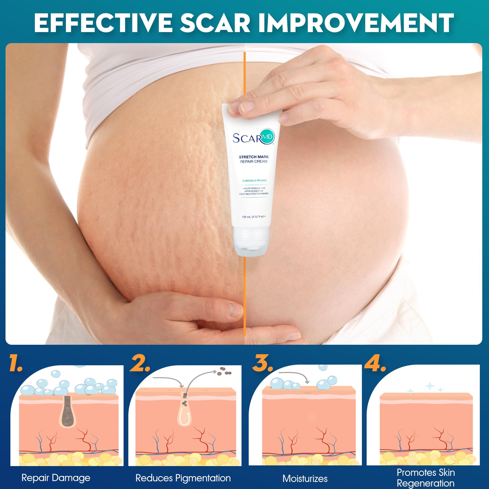 ScarMD Stretch Mark Repair Cream on bathroom shelf suggests a soothing daily routine.