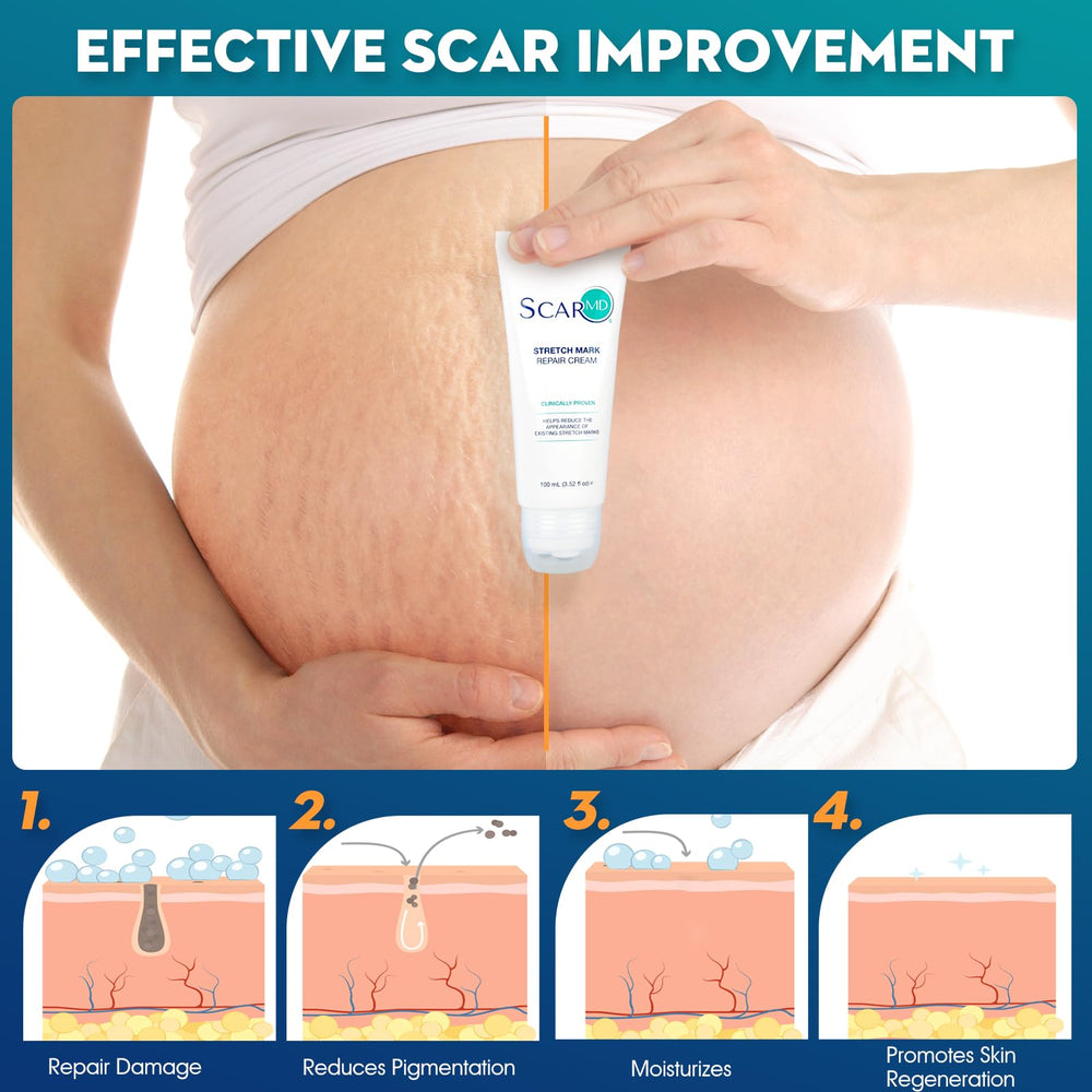 ScarMD Stretch Mark Repair Cream on bathroom shelf suggests a soothing daily routine.